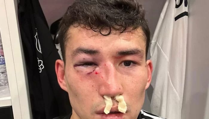 Beşiktaş’tan Bakhtiyor Zaynutdinov açıklaması! 2 kırık var!
